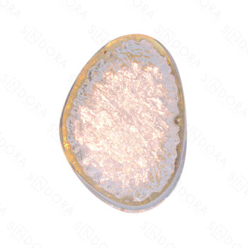 Arandela Metal Dourado e Acrilico 25X17X10CM- Sindora QB05194